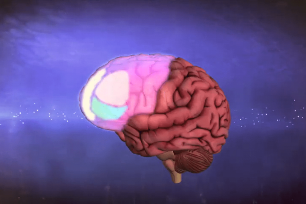 More Than a Personality Quirk: OCD is Debilitating, but Manageable