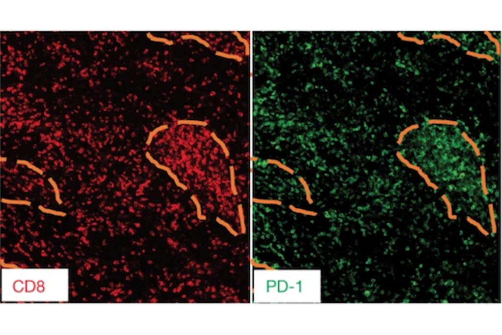 Immunotherapy for HPV+ head and neck cancer: awakening the force within