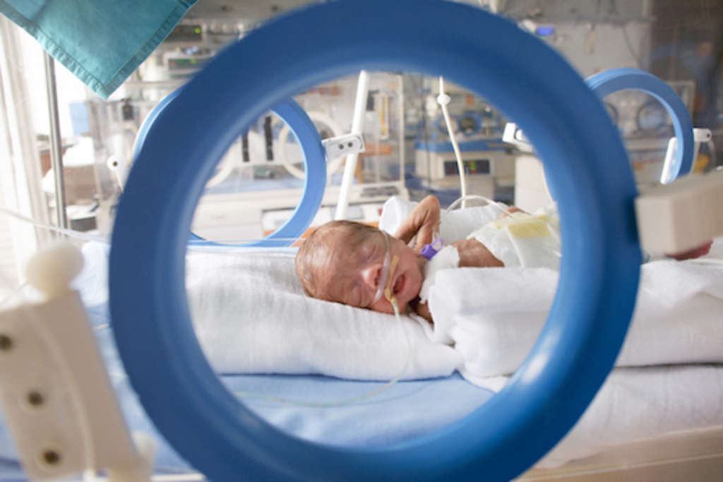 Female blood donors linked to better outcomes for transfused preterm infants