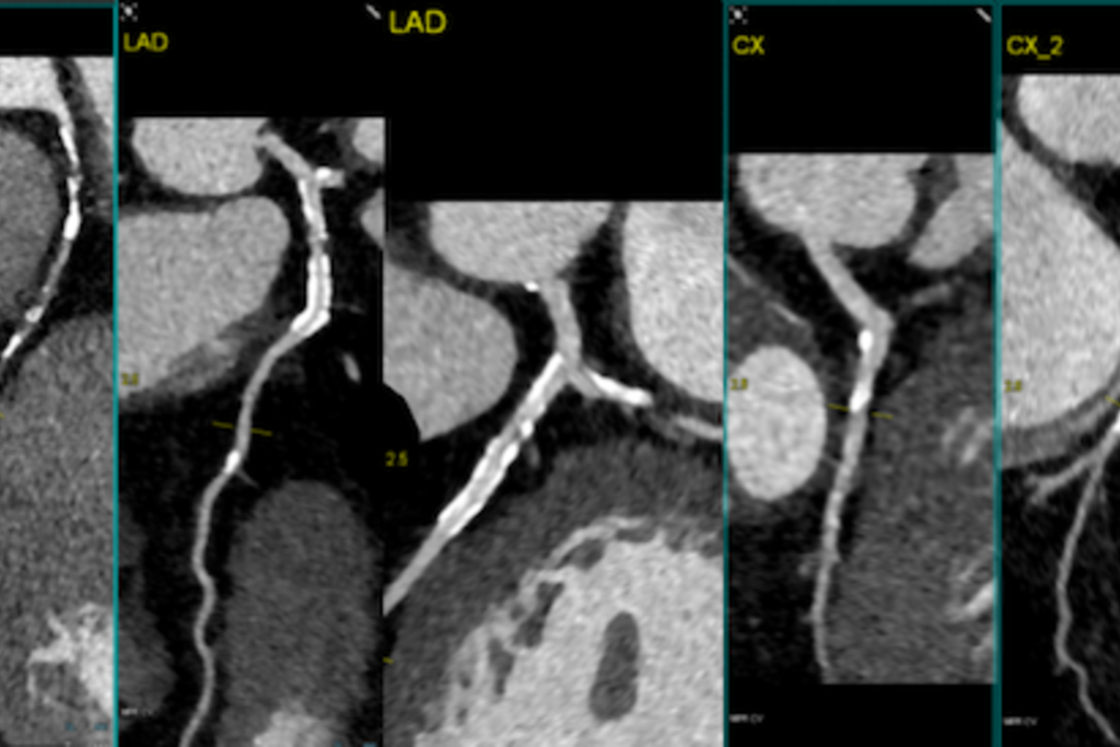 Study of cardiac imaging tests new CT-based procedure