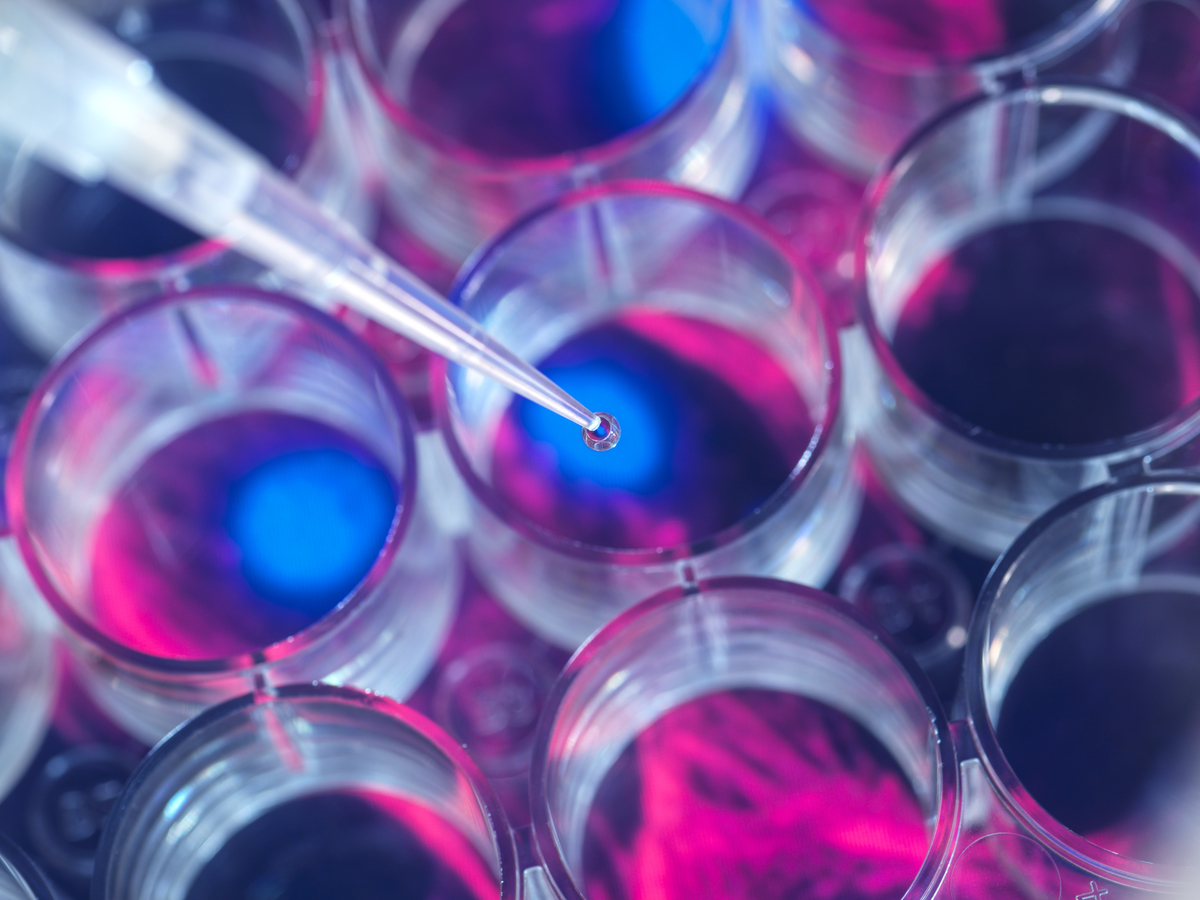 Close-up of a collection of petri dishes in the background and a pipette in the foreground.